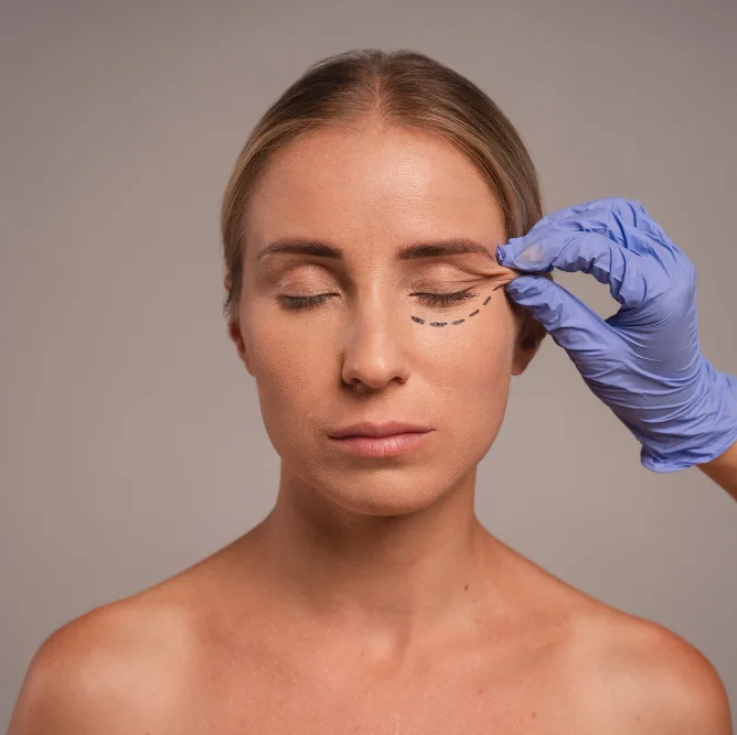 Blepharoplasty